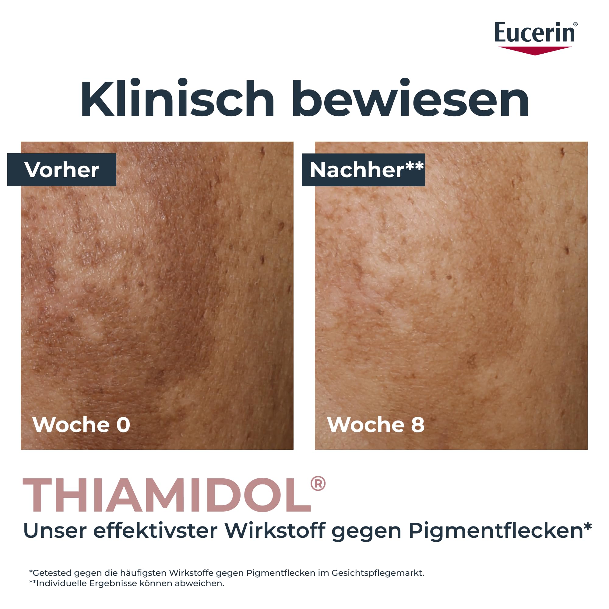 eucerin-anti-pigment-teint-perfektionierendes-serum-30-ml image 4