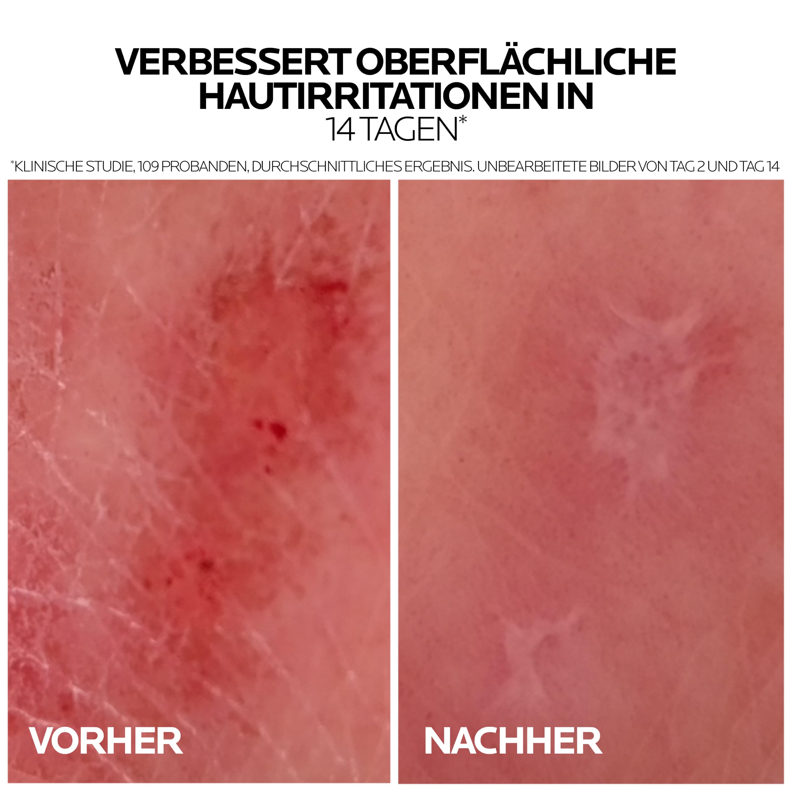 la-roche-posay-cicaplast-baume-b5-reparierende-pflege image 6