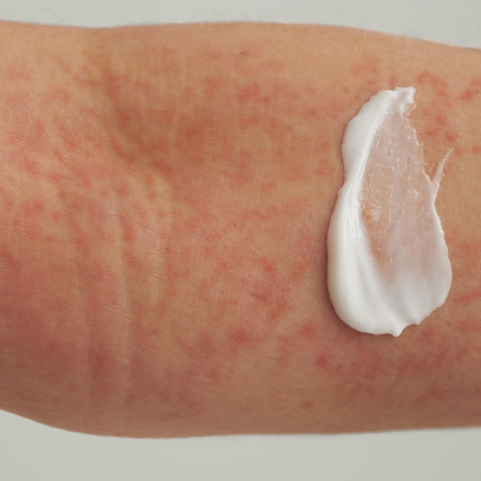 dado-sens-extroderm-duschcreme-200-ml-bei-neurodermitis-und-psoriasis image 3