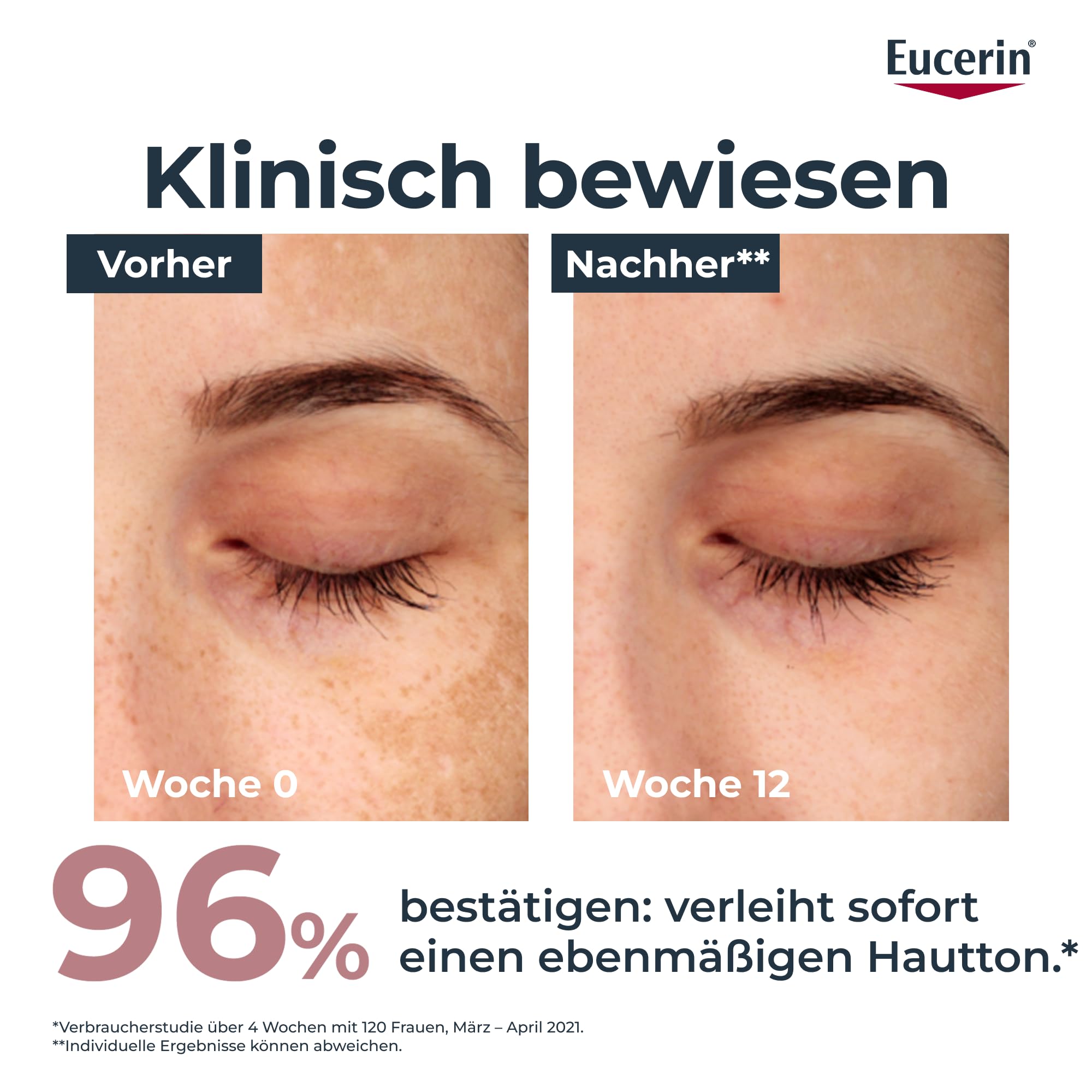 eucerin-anti-pigment-tagescreme-get-nt-lsf-30-50-ml image 4