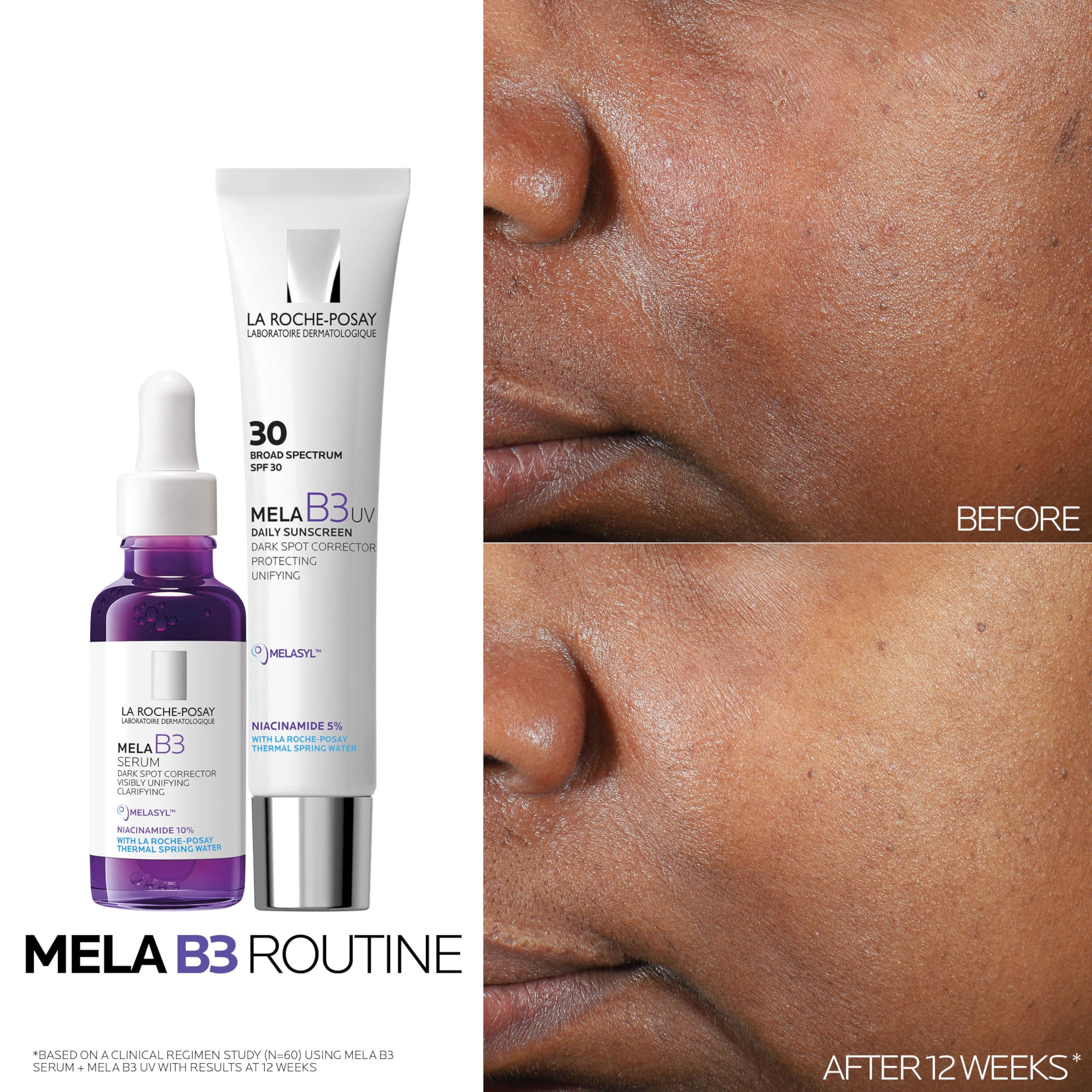 la-roche-posay-mela-b3-serum-50-ml-anti-pigmentflecken-konzentrat-mit-melasyl image 5