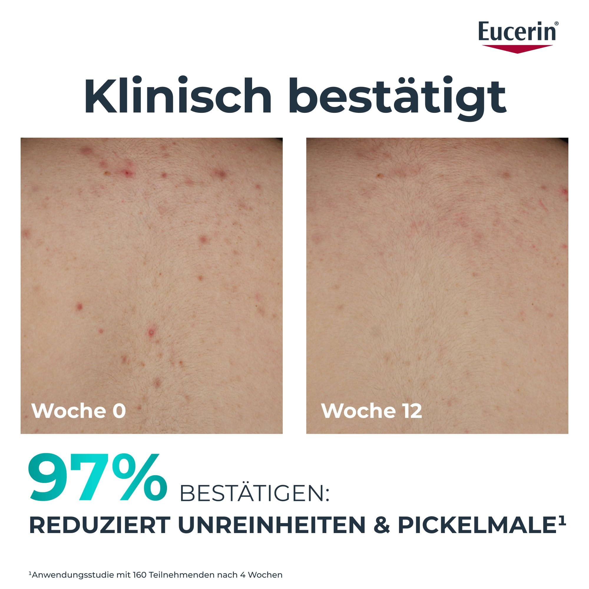 eucerin-dermopure-clinical-erneuernde-k-rperpflege-200-ml-bodylotion image 8