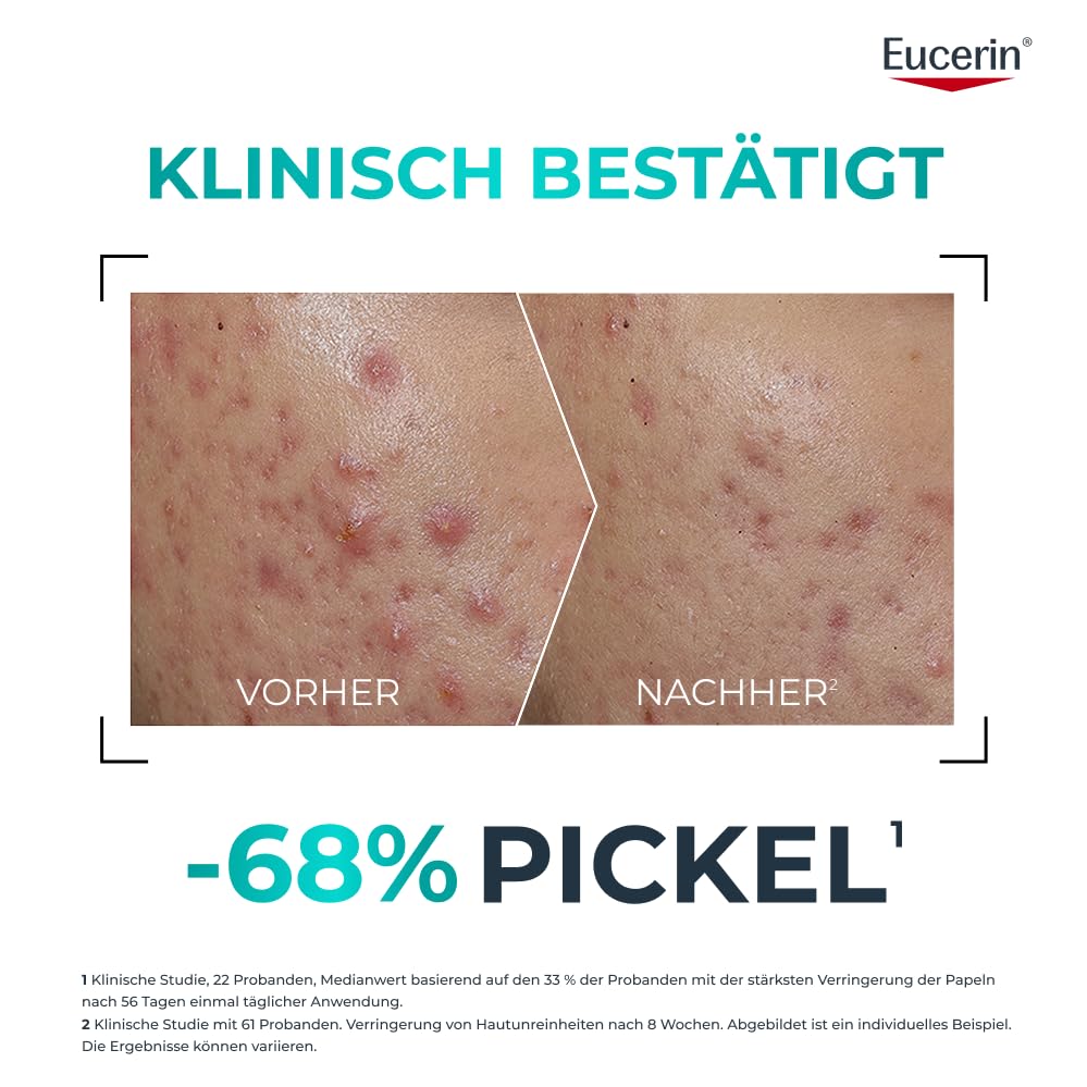 eucerin-dermopure-clinical-probiom8-set-gegen-unreine-haut-8-produkte image 5
