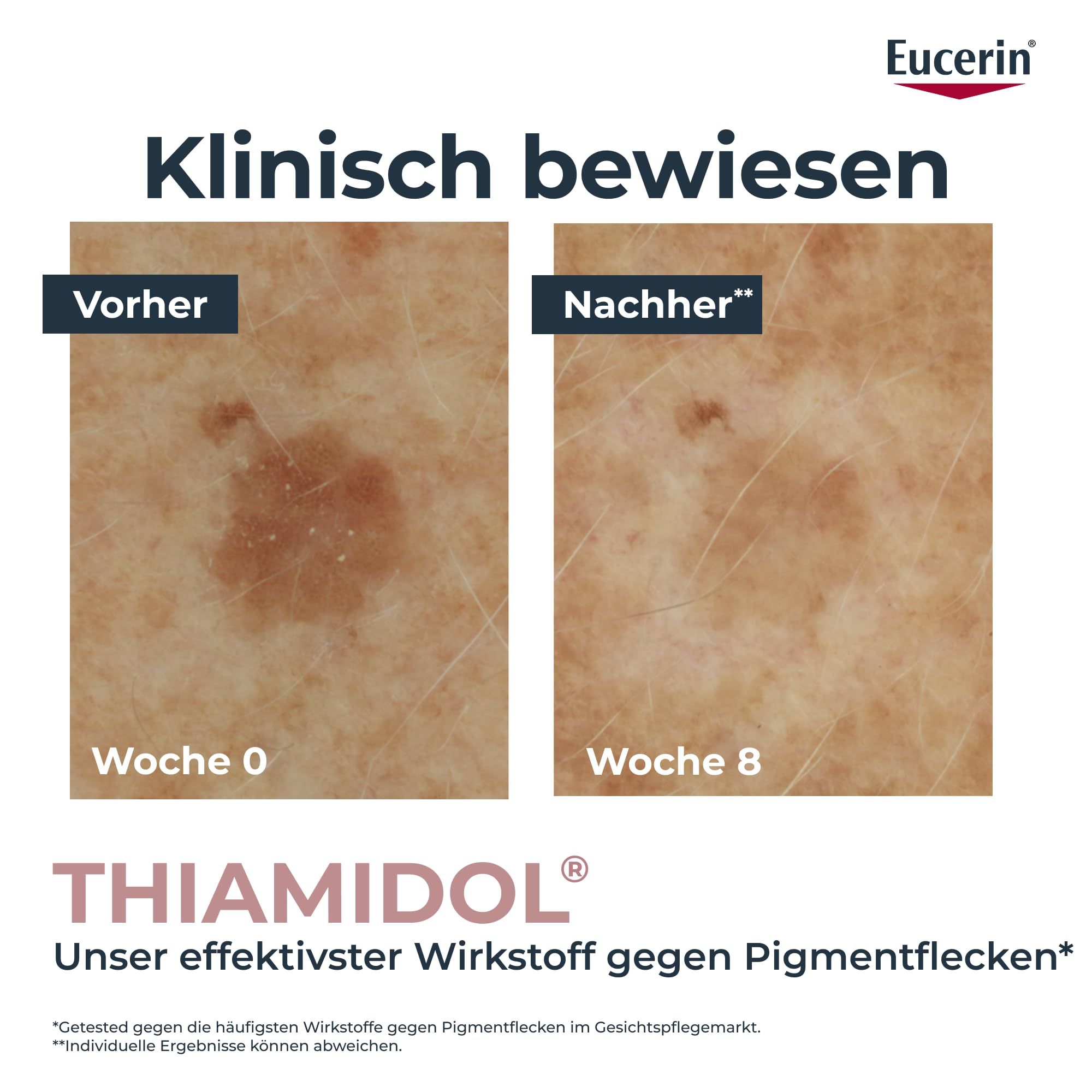 eucerin-anti-pigment-korrekturstift-serum-5-ml image 3