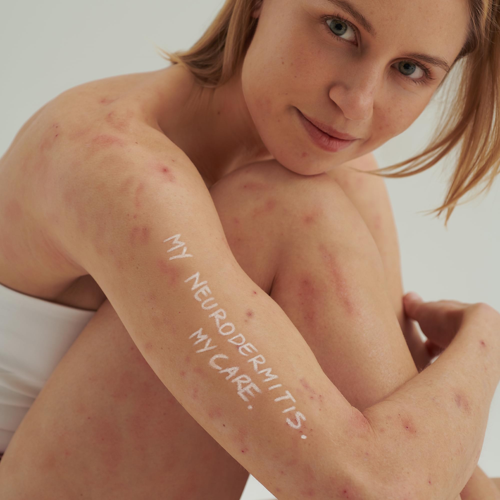 dado-sens-extroderm-augencreme-15-ml-bei-neurodermitis-psoriasis image 6