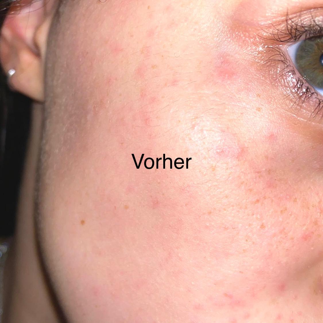 Okay, aber nicht der Heilsbringer