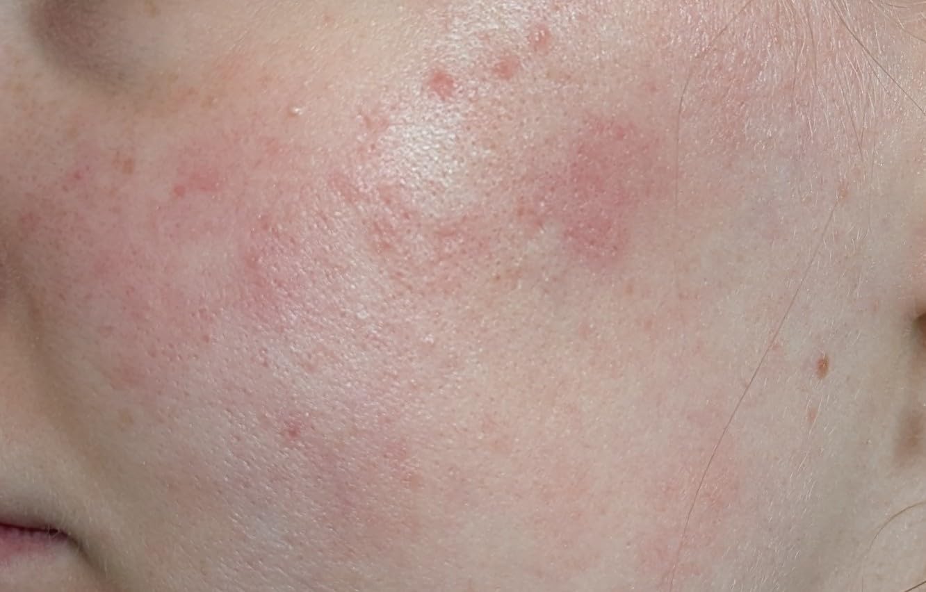 Gutes Serum