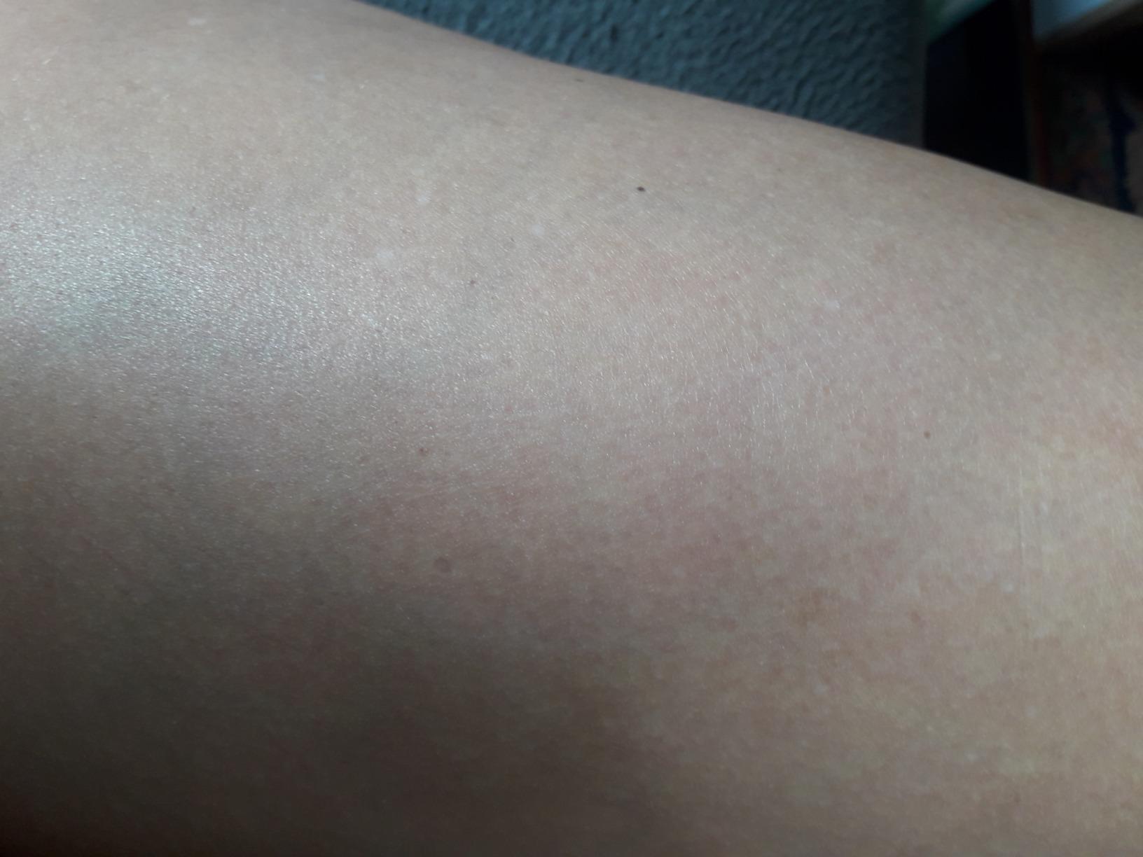 Perfekter Sonnenschutz