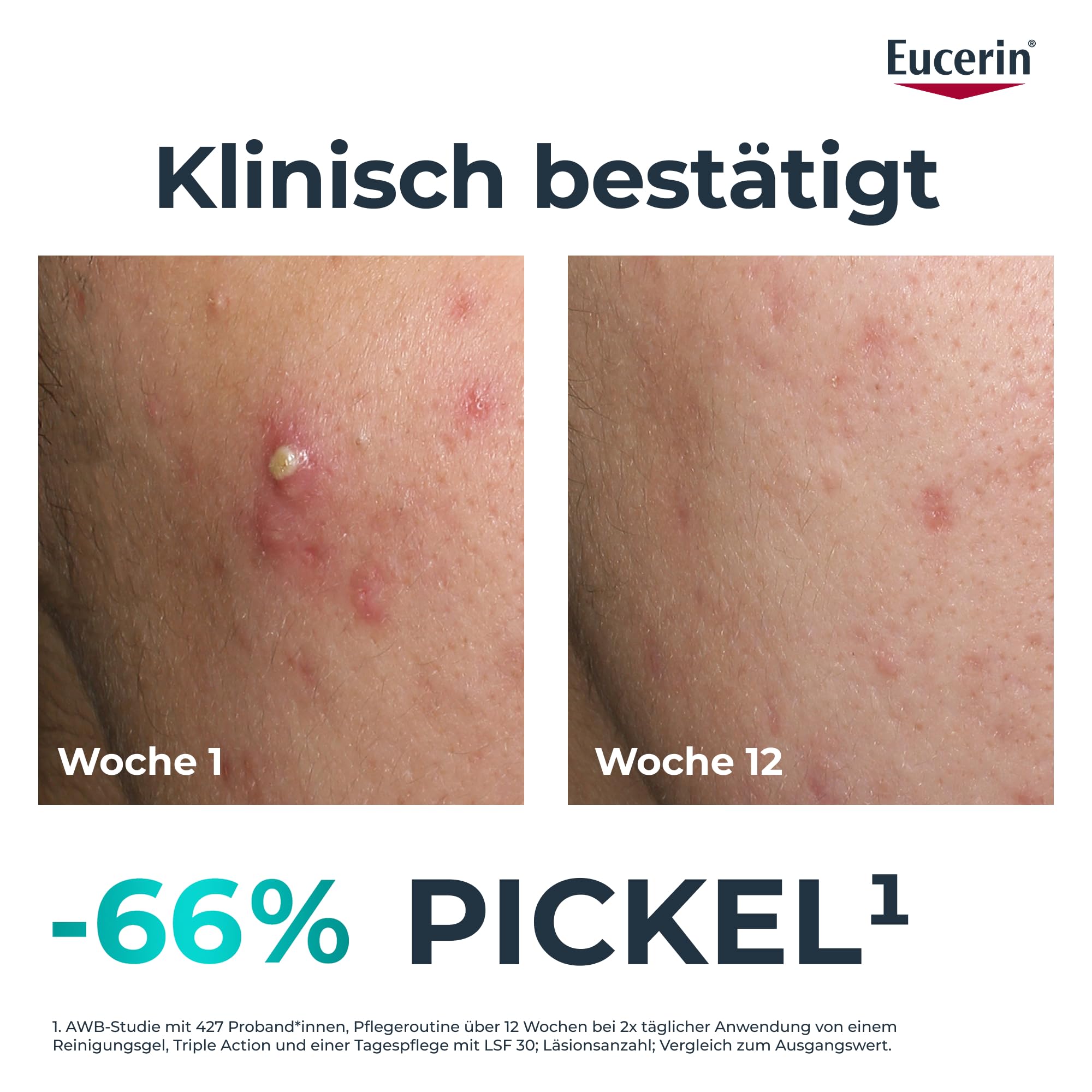 eucerin-dermopure-clinical-triple-action-pflege-gesichtsserum-40-ml image 3