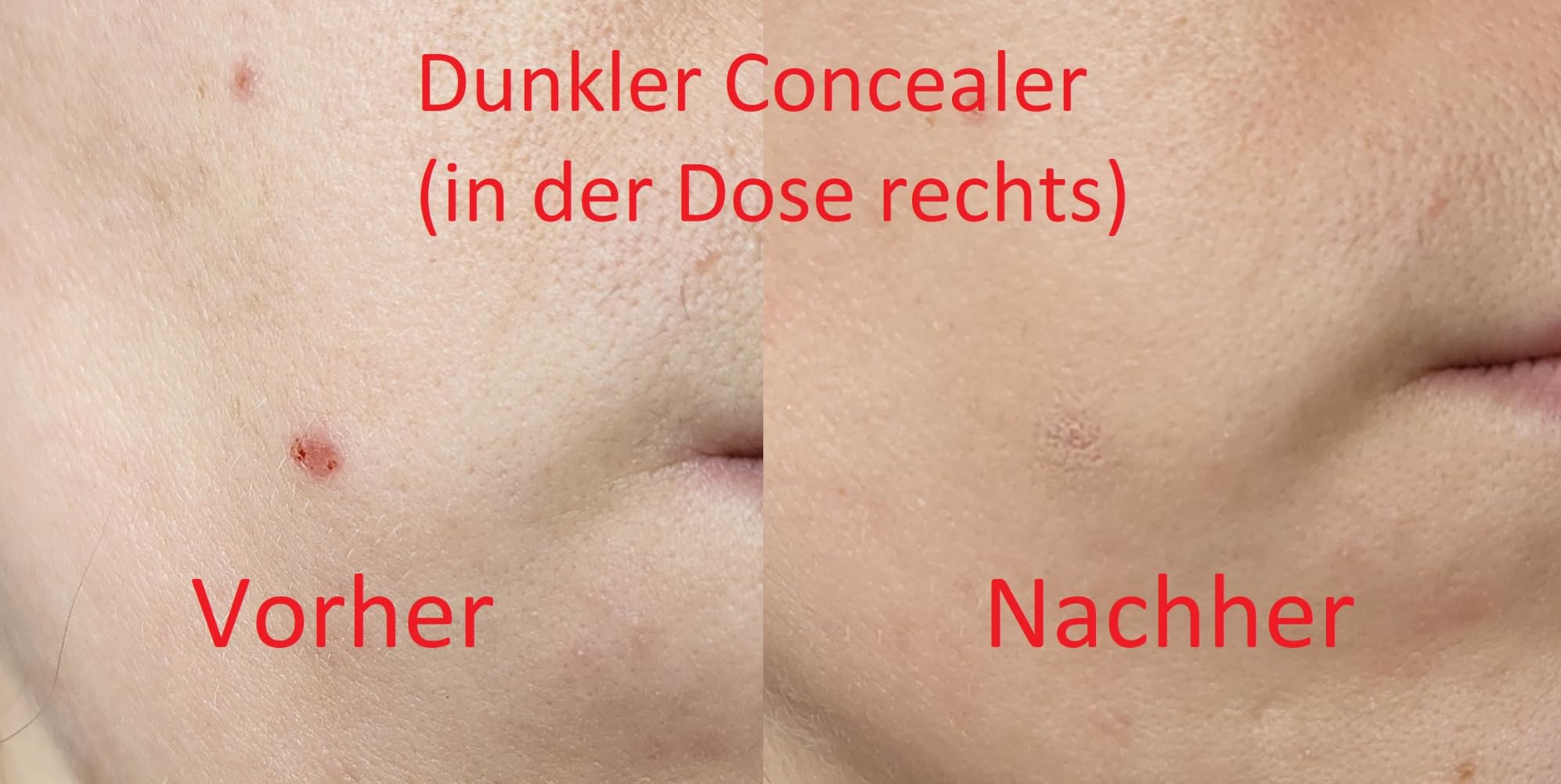 Endlich verträglich