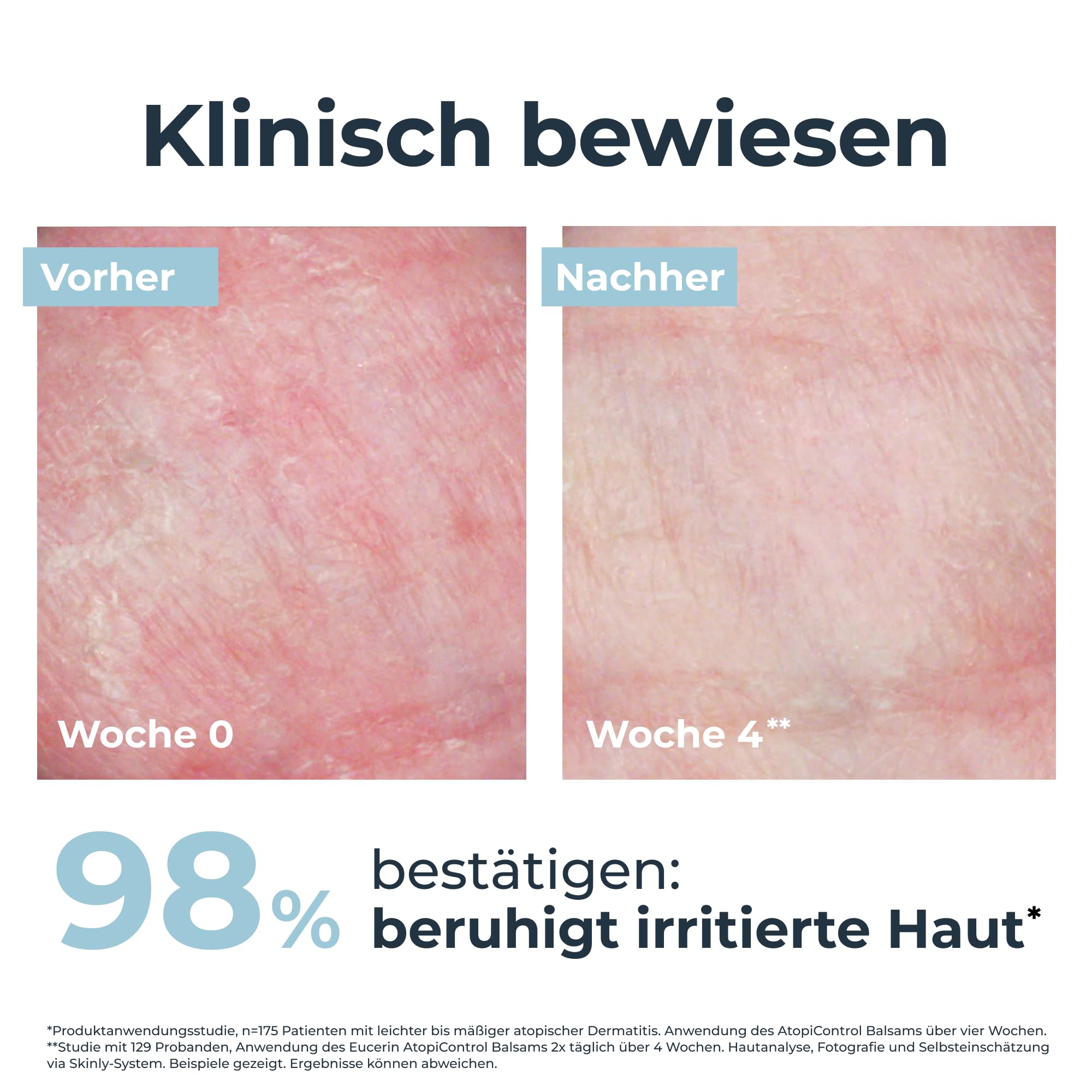 eucerin-atopicontrol-balsam-beruhigungspflege-400-ml image 3