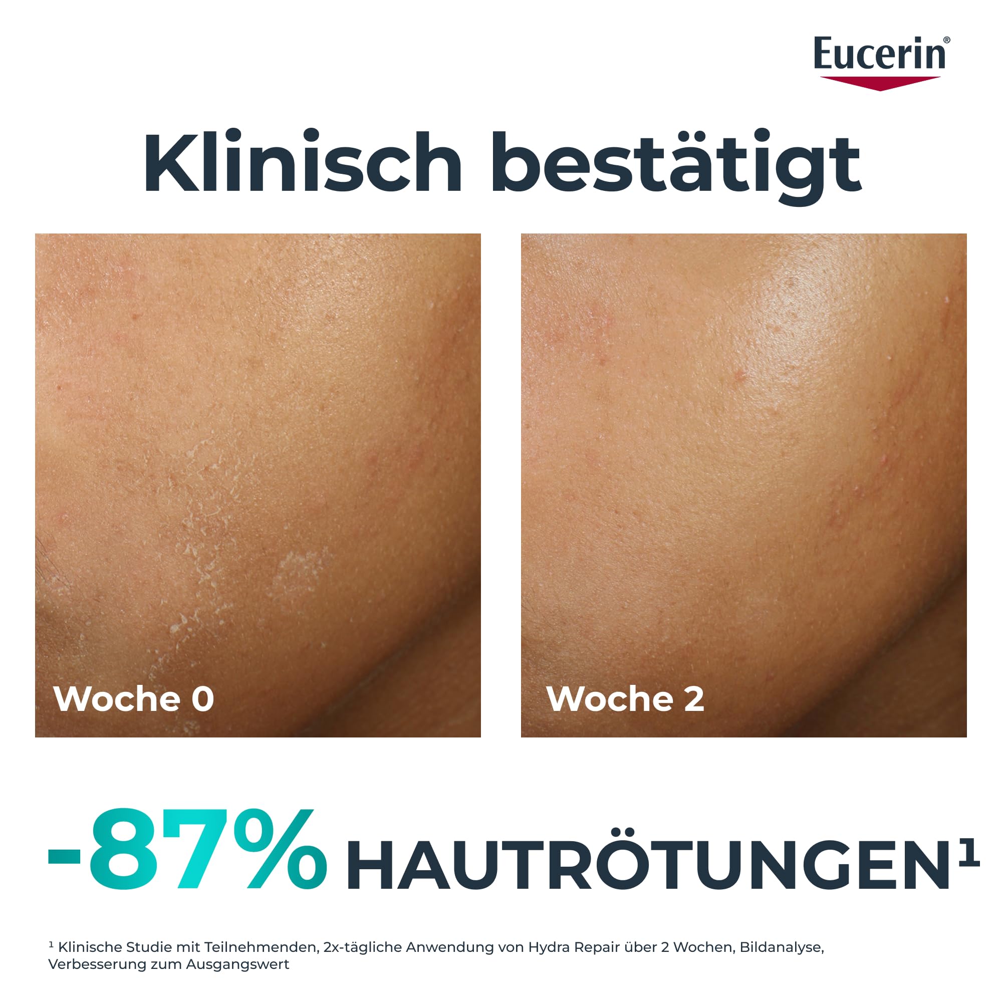 eucerin-dermopure-clinical-hydra-repair-feuchtigkeitspflege-40-ml image 3